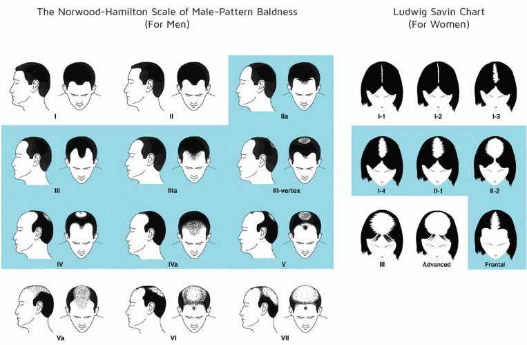 Patterns of Hair Falling out